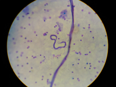 PARASITOLOGIA CLÍNICA